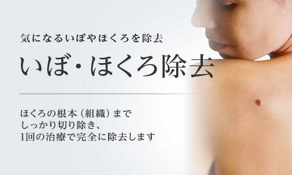 東京美容外科のバナー